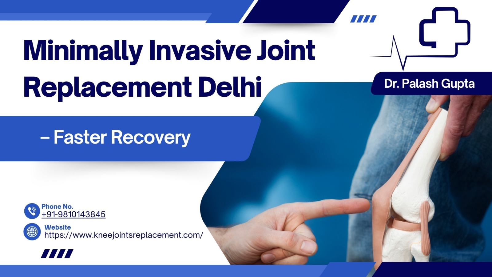 Minimally invasive knee replacement Delhi

